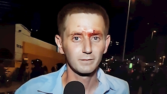 רועי ינובסקי הפצוע במהלך סיקור חסימת נתיבי איילון על ידי בני העדה האתיופית, צילום: מסך: כאן 11