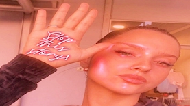 נטע אלחמיסטר בקמפיין stop this story, צילום: הקונגרס היהודי האירופי