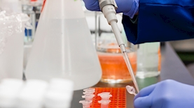 פיתוח חיסון, צילום: Martin Lopez from Pexels