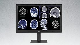 מסך LG לאבחון רפואי, צילום: יחצ LG