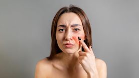 מחלת עור-אילוסטרציה, צילום: shutterstock