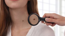 נקודות חן, צילום: shutterstock