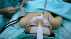 חולה מורדמת מונשמת. אילוסטרציה - למצולם אין קשר לנכתב, צילום: נתי שוחט/פלאש 90