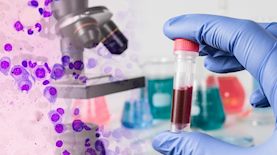 מיאלומה, צילום: shutterstock