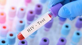 איידס, צילום: shutterstock