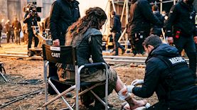 שחקנית נפצעה, צילום: AI