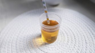 בדיקת שתן ביתית, צילום: Shutterstock